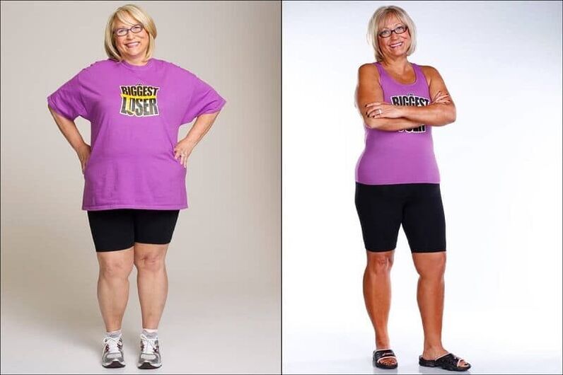 Mujer antes y después de perder peso